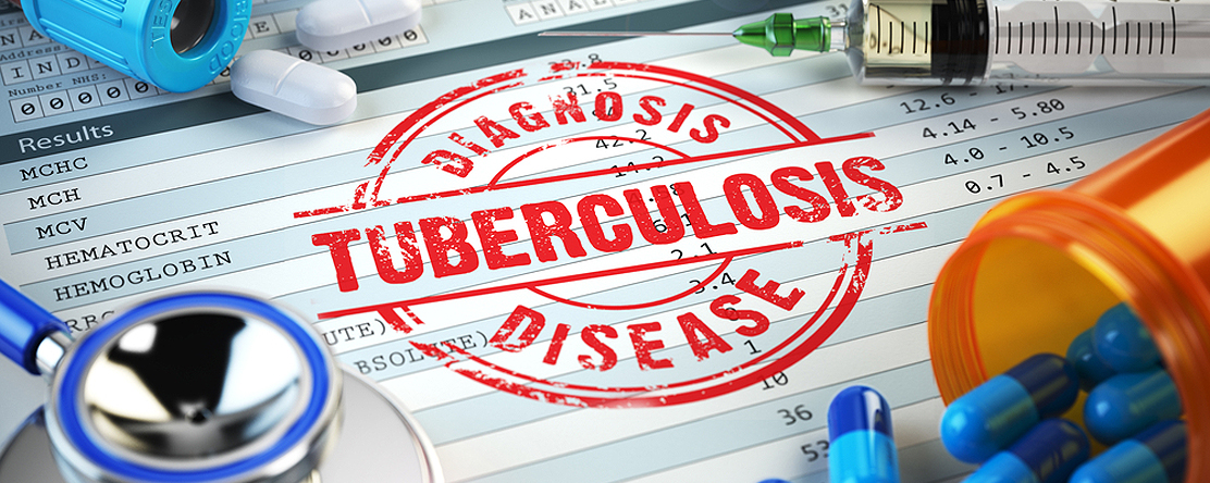 image: paper with stamp of "Diagnosis tuberculosis disease"
