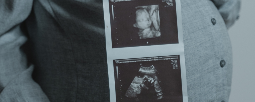 Pregnant woman holding a picture of her baby's ultrasound