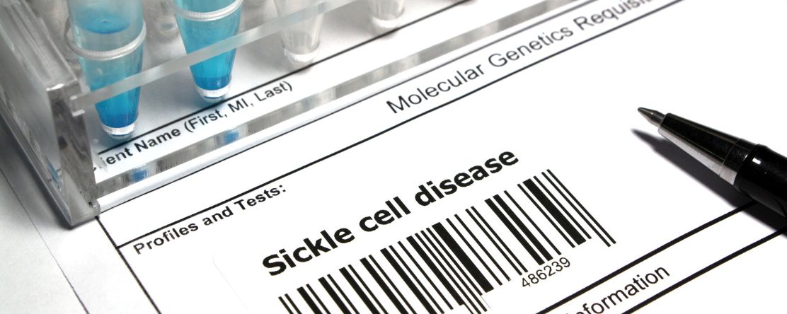 test tubes on top of paper that says sickle cell disease